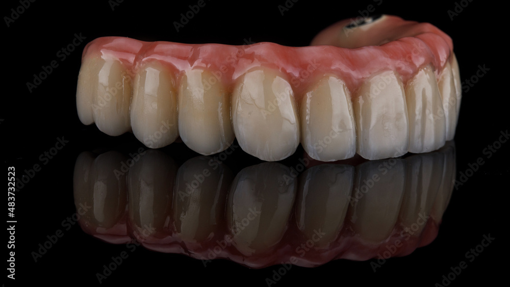 macro photo of a dental prosthesis of the upper jaw on a black background with excellent reflection macro photo of a dental prosthesis of the upper jaw on a black background with excellent reflection