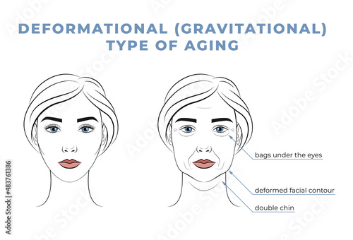 Deformational type of aging on the face. The face of a woman in her youth and old age.