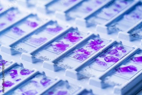 Fotografía Rows of microscope glass slide in the cells