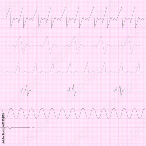 Cardiogram paper. Cardiac pulse icon. Heart beat. Cardiology ign. Medicine concept. Vector illustration. Stock image. 
