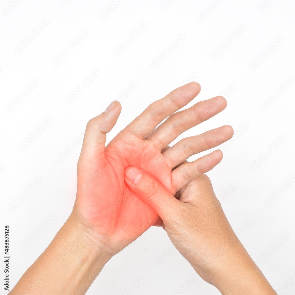 Painful palm of Asian man. Concept of compartment syndrome, cellulitis and hand muscles pain. Painful palm of Asian man. Concept of compartment syndrome, cellulitis and hand muscles pain.