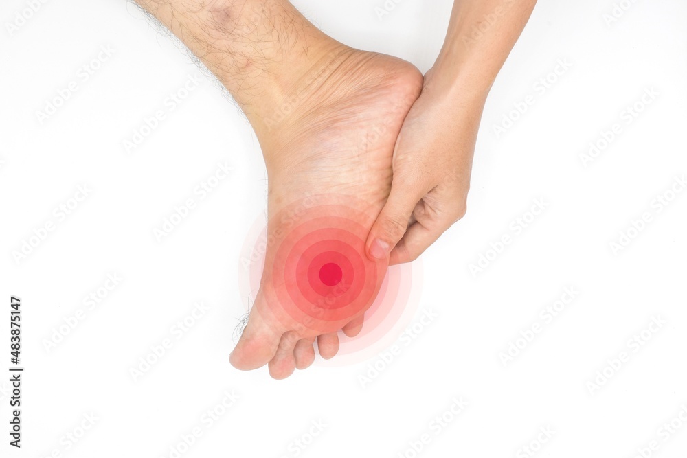 Tingling and burning sensation in foot of Asian young man with diabetes