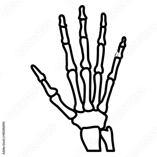 Hand Xray