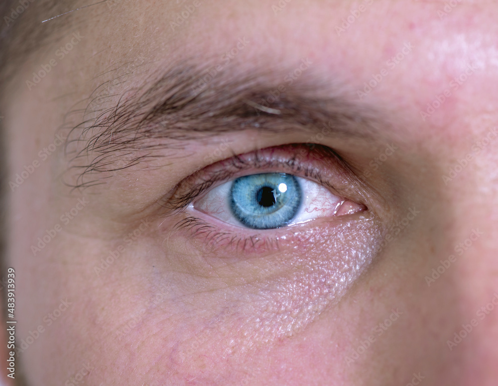 Obraz premium Man with blue eyes and a corrective contact lens.