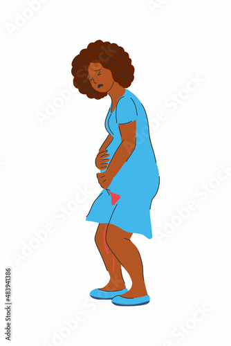 miscarriage and abortion. uterine bleeding. black pregnant woman has misbirth. Rh-conflict during pregnancy. spotting from the vagina. stock vector illustration isolated on white.