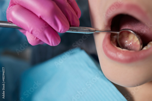 A close-up of a young girl getting a dental exam by dentist and using dental mirror to see baby teeth and gums. photo