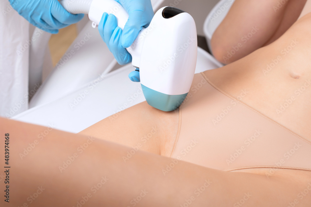 Naklejka premium Elos epilation hair removal procedure on a woman’s body. Beautician doing laser rejuvenation on the lower leg in a beauty salon. Removing unwanted body hair. Hardware ipl cosmetology