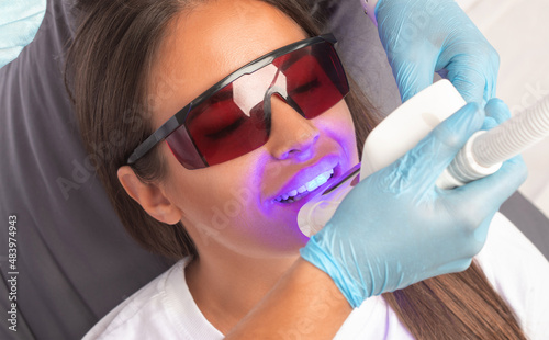 The dentist makes a teeth whitening procedure in the clinic to a young beautiful woman. A healthy smile.