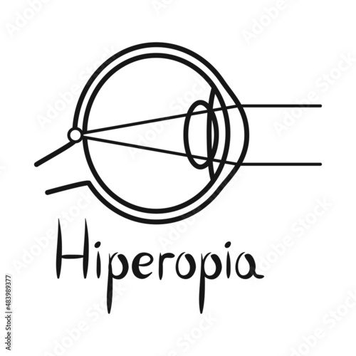 Vector illustration of hyperopia and eyeball logo. Web element of hyperopia and eye stock vector illustration.