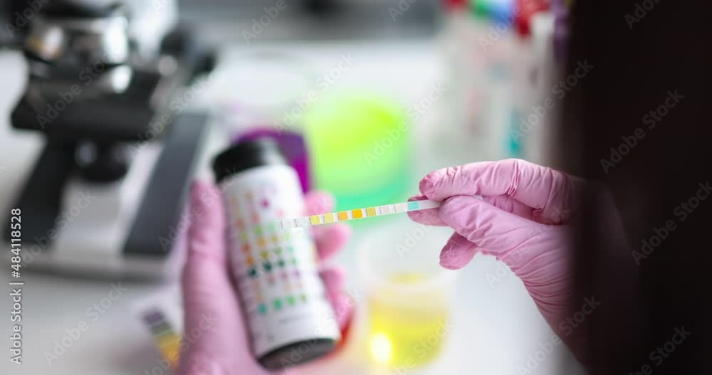 Urine medical examination strip and getting result closeup Urine medical examination strip and getting result closeup