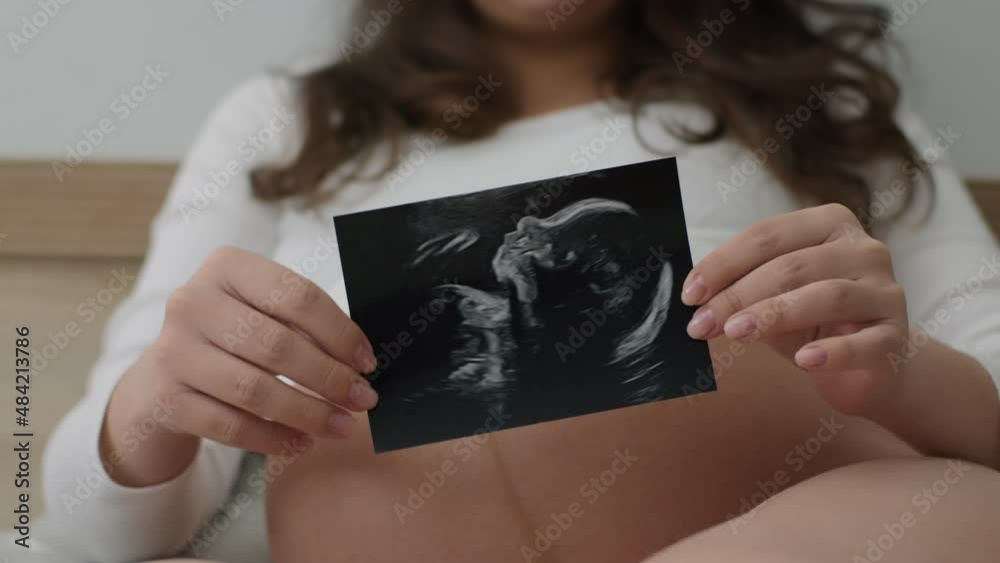 Pregnant woman shows an ultrasound photo of unborn baby to camera and shakes it. Unrecognizable expectant mother shows off an image of baby in womb of lying on bed