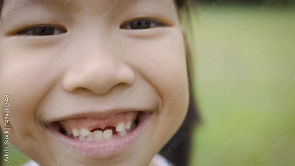 Portrait of young happy asian little girl have fun in the park. Close up smile face girl. Beautiful little girl 7 years old has lost milk teeth. Loss of milk teeth, replacement of permanent teeth.
Portrait of young happy asian little girl have fun in the park. Close up smile face girl. Beautiful little girl 7 years old has lost milk teeth. Loss of milk teeth, replacement of permanent teeth.