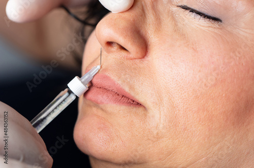 Female cosmetology in a beauty salon. Doctor nose tip correction and lifting. 