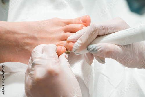 A Podiatrist doctor who takes care of a woman's toenails. Cosmetic procedures of the feet