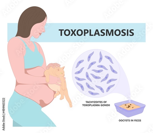 Toxoplasmosis cyst Fecal life cycle cat retina eye hiv aids mother child retina pet women animal faece poop fetal birth defect T. gondii poo meat pork virus fungi