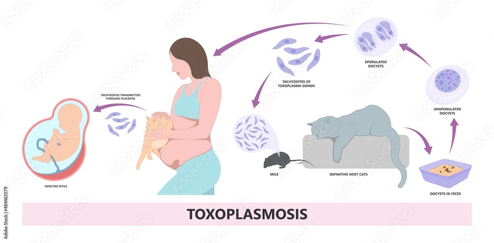 toxoplasmosis birth defects