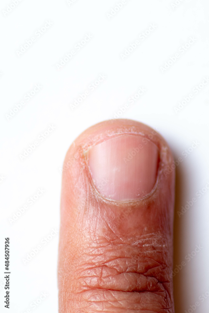 Toes, hands and nails. Male human body parts 20 to 30 years old Toes, hands and nails. Male human body parts 20 to 30 years old