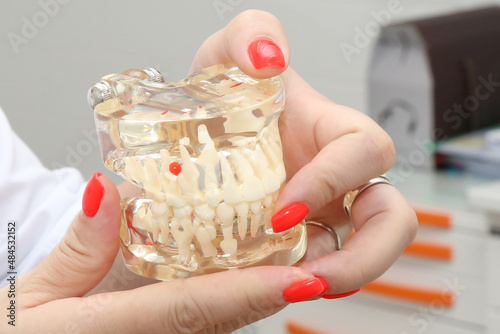 the doctor holds a mock-up of the patient's jaw in his hands photo