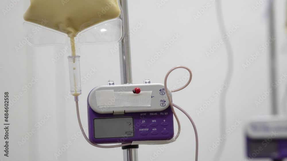 Feeding Pump medical device purple color to supplement nutrition liquid food to tube Enteral feeding fluid set bag with clamp hanging on stand.
