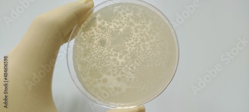 Bacillus subtilis growth picture photo