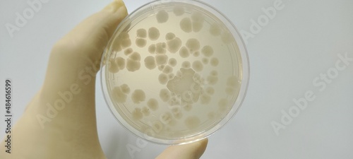 Bacillus subtilis growth picture