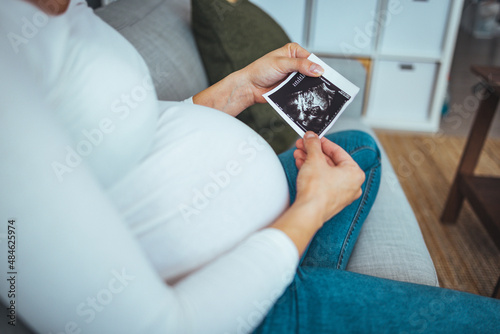 Pregnant woman looking at her baby sonography. Happy expectant lady enjoying first photo of her unborn child, anticipating her future life..
