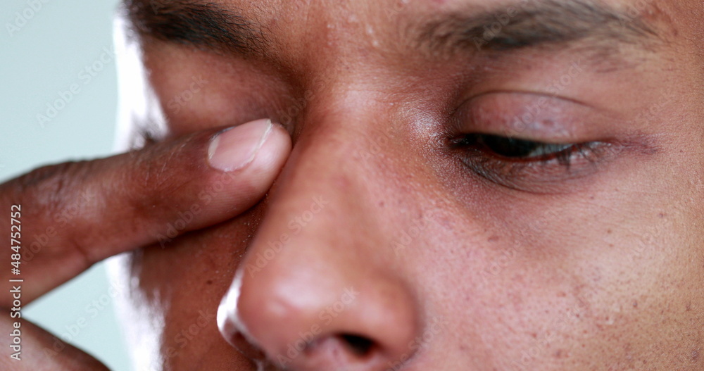 Man touching face rubbbing eye with finger and hand
