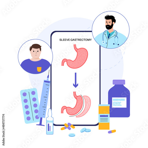 Laparoscopic sleeve gastrectomy