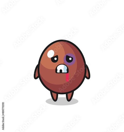 injured chocolate egg character with a bruised face