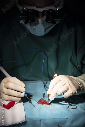 Tablou pe pânză performance of single-stremity microsurgery by a female traumatologist-surgeon