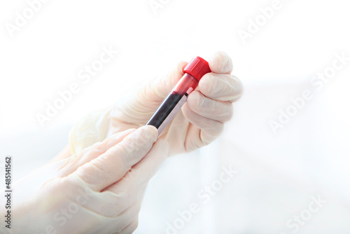 A test tube with blood in the hands of a nurse. A test tube for collecting blood.Blood testing. Biological material. Only hands in protective gloves.Copy space.