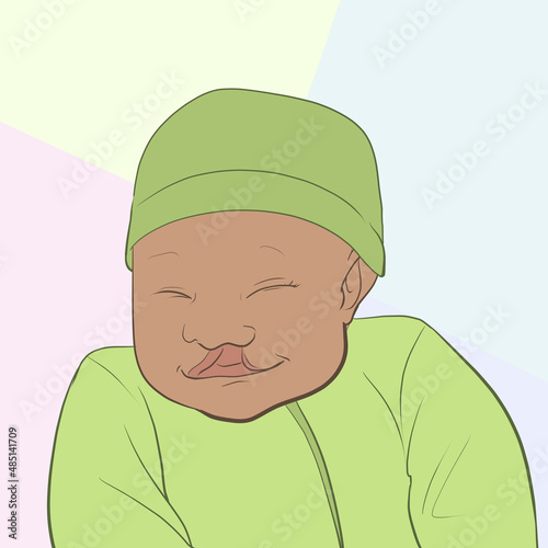Baby with Cleft Pallet  photo