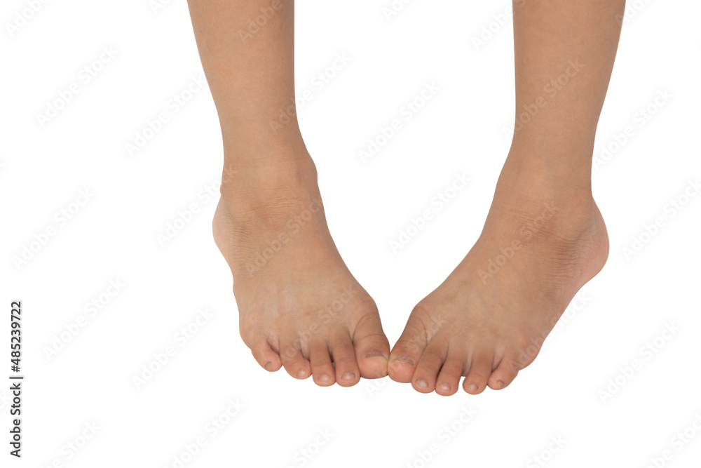 Cute kid leg, fast growing foot, isolated on white background. Stock