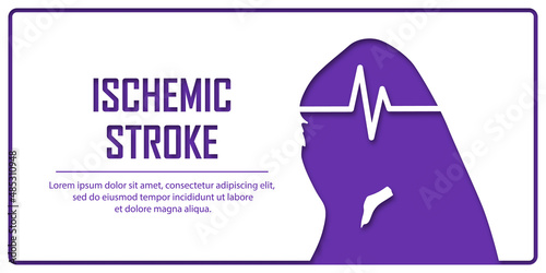 People suffering from ischemic stroke. Ischemic stroke patient concept. Medical help. People silhouette in paper cut style. Stroke types poster, banner. Medical vector illustration