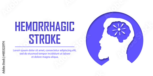 People suffering from hemorrhagic stroke. Hemorrhagic stroke patient concept. Medical help. People silhouette in paper cut style. Stroke types poster, banner. medical vector illustration