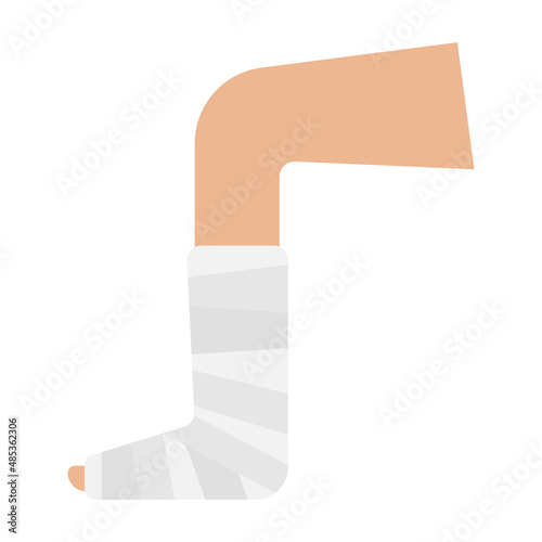 broken leg