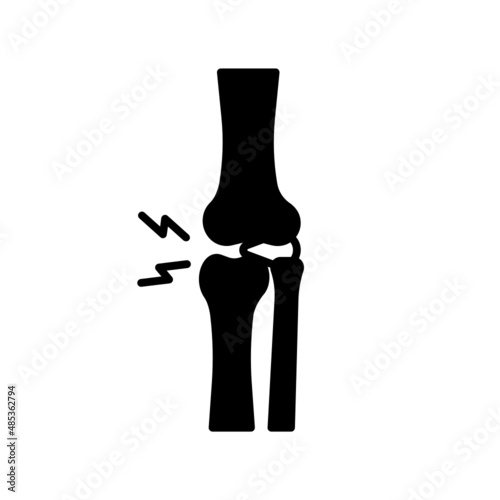 knee arthrosis