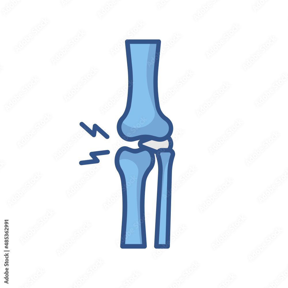 knee arthrosis knee arthrosis