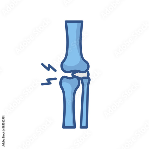 knee arthrosis