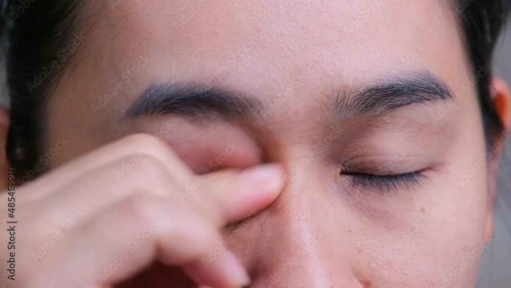 Asian woman rubbing her eyes, itching, pain and irritation of the sclera from airborne dust. Health care concept. Asian woman rubbing her eyes, itching, pain and irritation of the sclera from airborne dust. Health care concept.