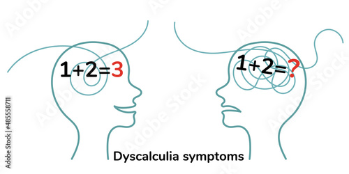 Dyscalculia symptoms. Head silhouette with mathematical examples. Illustration isolated on white background.