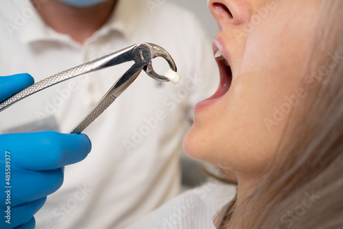 close-up of forceps for extraction of teeth and a tooth in them. The concept of going to the dentist.