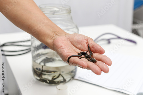 Photos Medical leeches in hand against the background of a jar with medical leeches