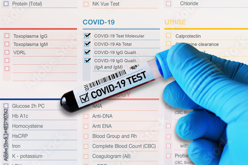 Blood tube test with requisition form for Covid-19 testing. Blood sample tube for analysis of Covid-19 positive in laboratory photo