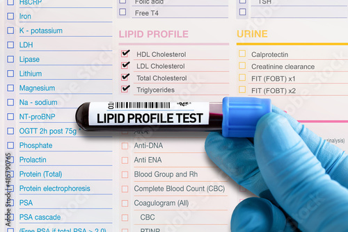 Blood tube test with requisition report for Lipid test. Blood sample tube for analysis of lipid profile test in laboratory. photo