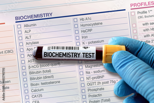 Blood tube test with requisition form for Biochemistry test. Blood sample tube for analysis of Biochemistry in laboratory photo