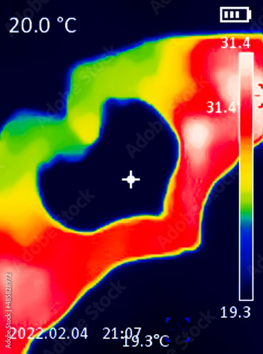 A A thermographic image of a hand with a human heart, showing different temperatures in different colors, from blue indicating cold to red indicating heat, may indicate inflammation of the joints.  photo