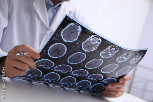 Doctor examining MRI images of patient with multiple sclerosis at table in clinic, closeup photo