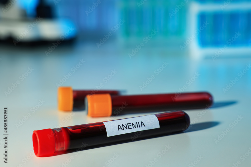 Test tubes with blood samples and label Anemia on white table against blurred background, closeup. Space for text Test tubes with blood samples and label Anemia on white table against blurred background, closeup. Space for text