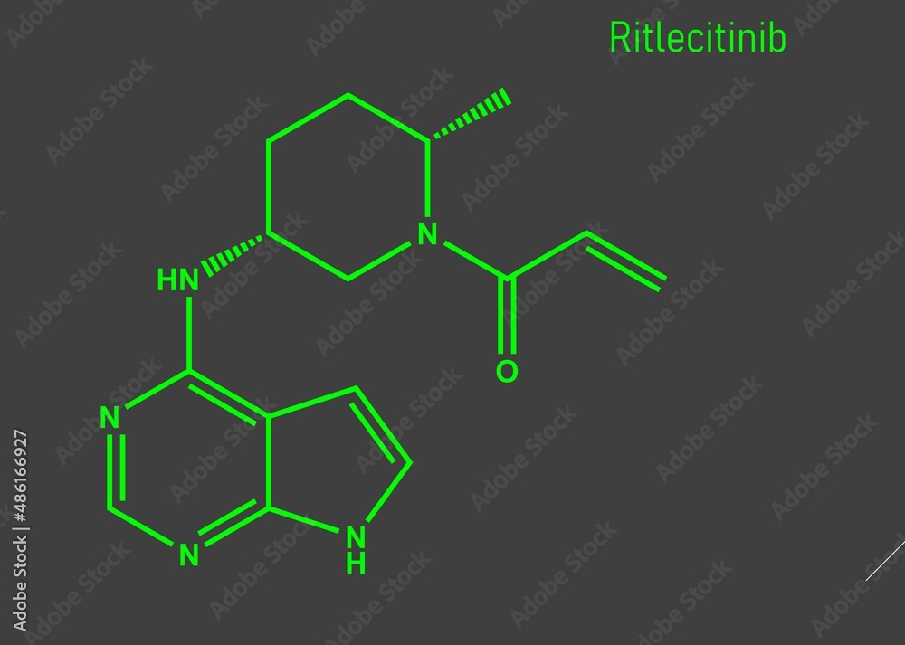 Ritlecitinib offers a novel mode of action, rapid onset, and the